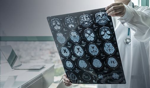 Traumatic Brain Injury (TBI)