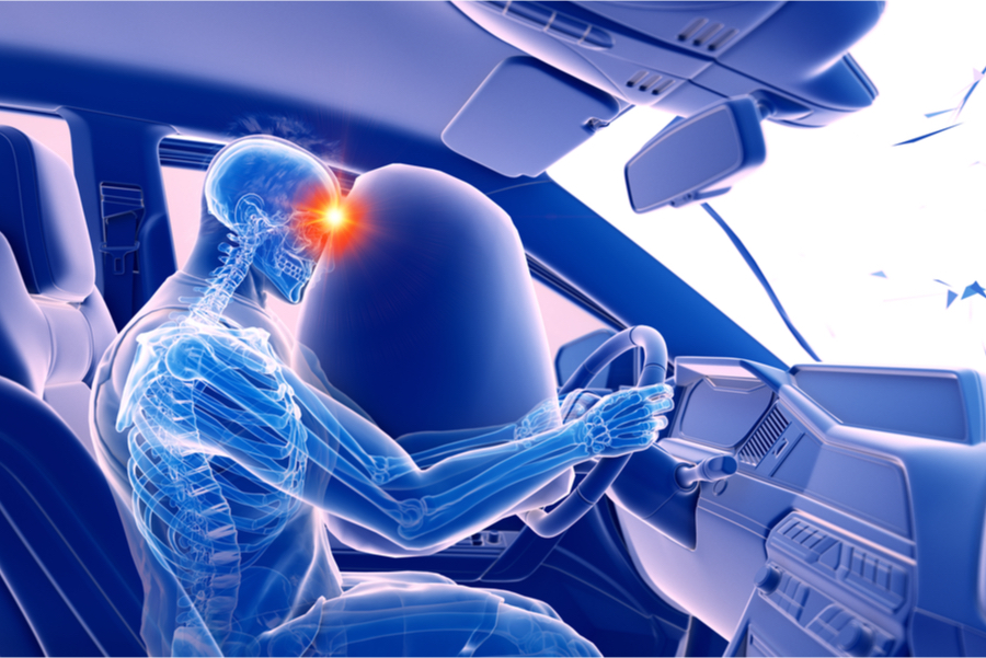 auto accident brain injuries